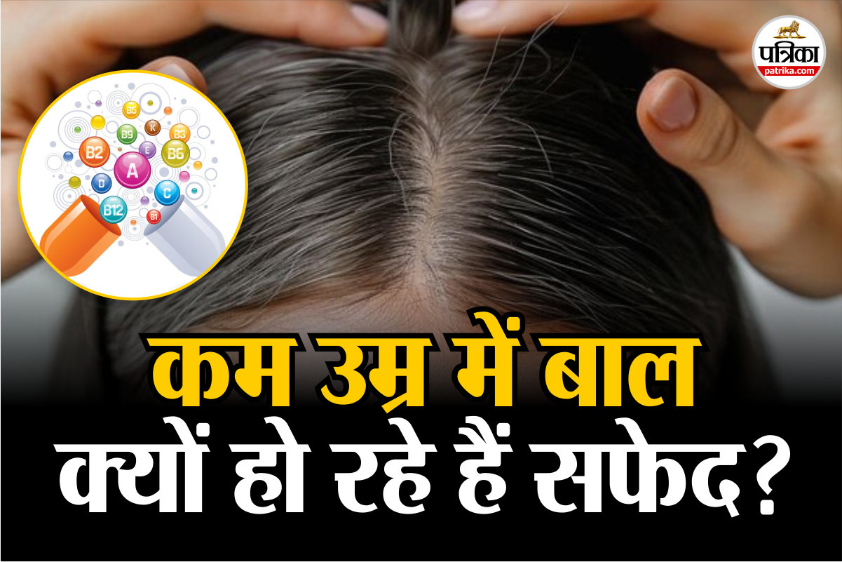 White Hair Reason: कम उम्र में सफेद बाल? यह एक विटामिन आपकी हेयर हेल्थ बिगाड़ सकता है