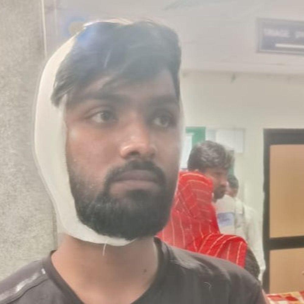 कलमा न पढ़ने पर एएमयू के हिंदू छात्र को पीटा​​​​​​​:सिटी स्कूल में 11वीं का छात्र है पीड़ित, पिस्टल की बट मारकर घायल करने का आरोप