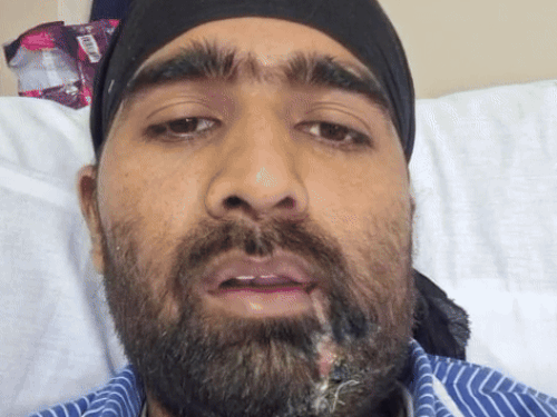 रूस में फंसे पंजाबी युवक का VIDEO:बोला-धोखे से फौज में भर्ती किया, लड़ने के लिए भेजा, बीस दिन से मोस्को अस्पताल में भर्ती