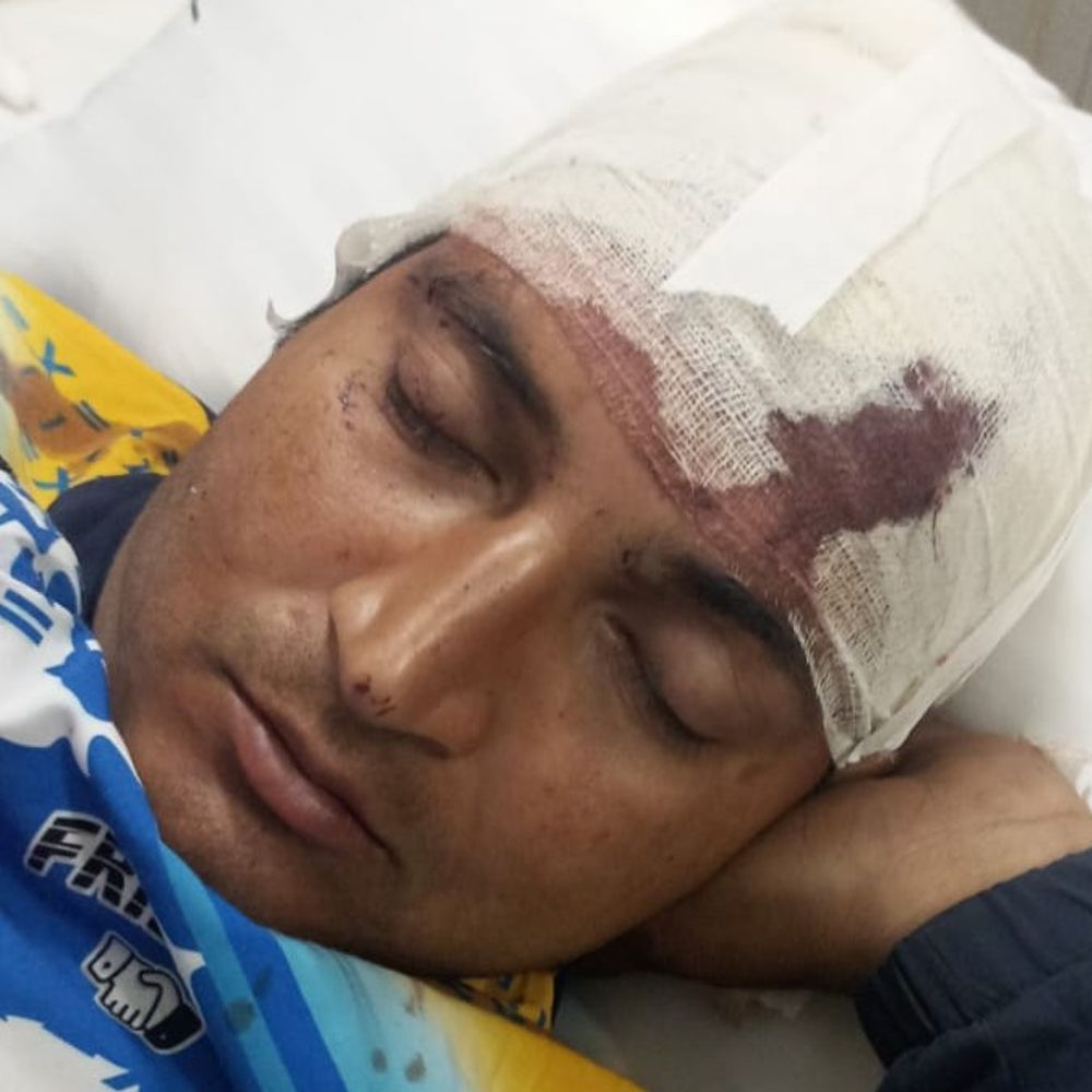 मेरठ में दिल्ली पुलिस कॉन्स्टेबल का हमला:रास्ते से कार हटाने को लेकर पड़ोसी के सिर में फावड़ा मारा