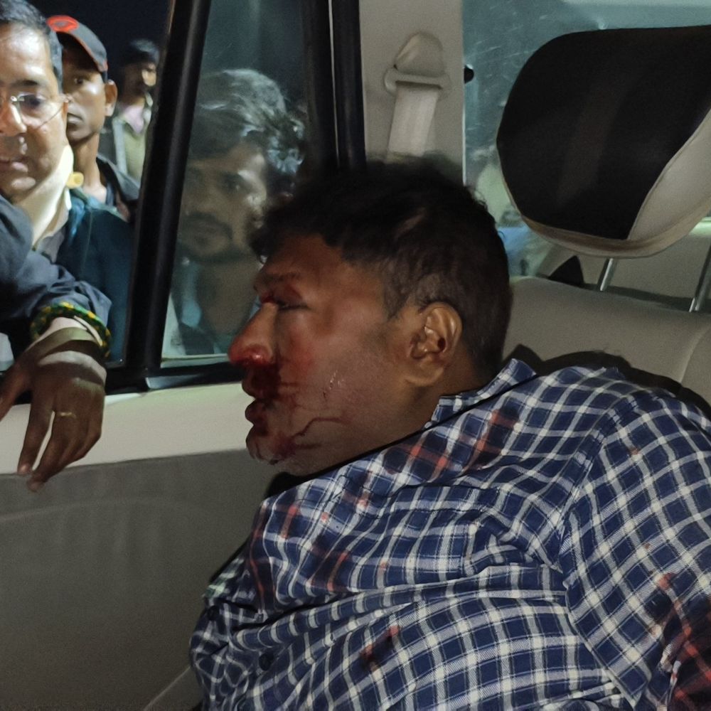 मुफस्सिल थाना के पास स्कॉर्पियो-बाइक की टक्कर:व्यक्ति गंभीर रूप से घायल, पूर्णिया जीएमसीएच रेफर