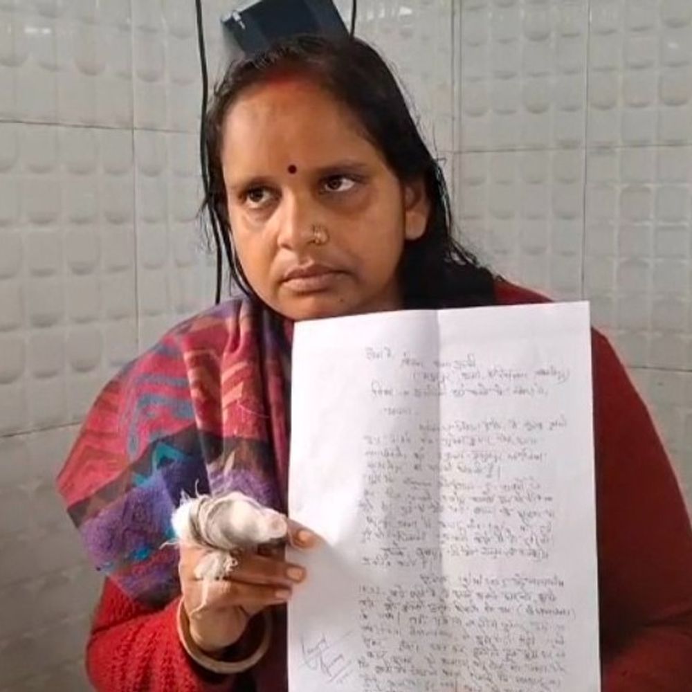 समस्तीपुर में आंगनबाड़ी सेविका को पति ने पीटा:रुपए नहीं देने पर हथौड़ी से बेरहमी से मारा, बोली- दहेज के लिए प्रताड़ित करते थे