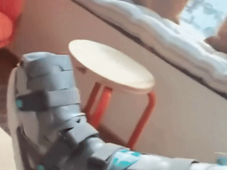 श्रद्धा कपूर ने दिया हेल्थ अपडेट:पैर में बंधा प्लास्टर दिखाकर कहा- थोड़ा रेस्ट करना है; फिल्म ईथा की शूटिंग के सेट पर लगी थी चोट