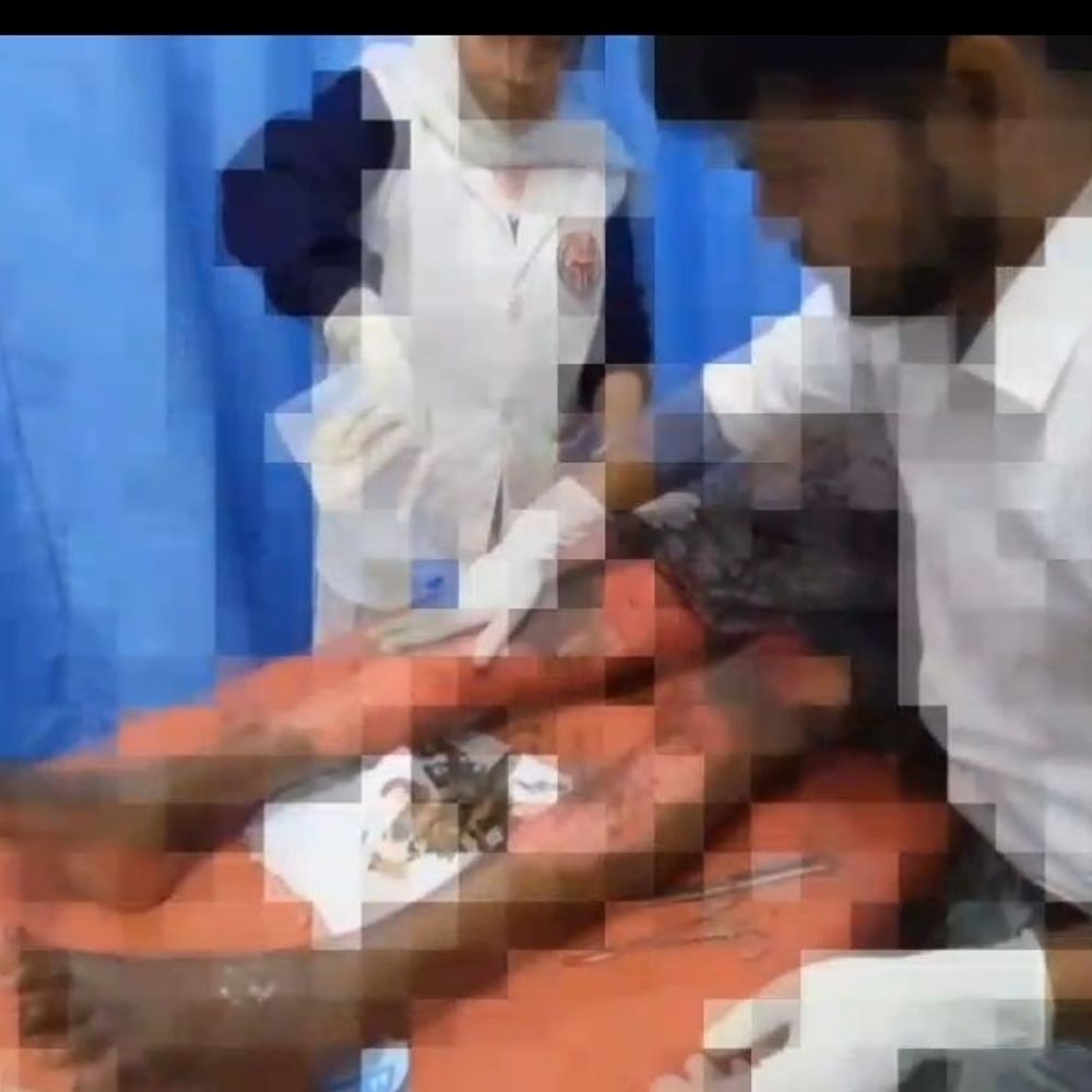 शकुराबाद में आग से झुलसी वृद्ध महिला:जहानाबाद सदर अस्पताल रेफर, खतरे से बाहर