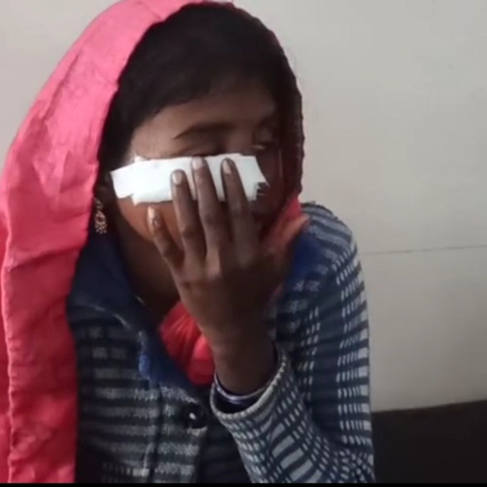 घरेलू विवाद में जेठानी ने देवरानी पर हमला किया:चेहरे पर आई चोट, जिला अस्पताल में भर्ती