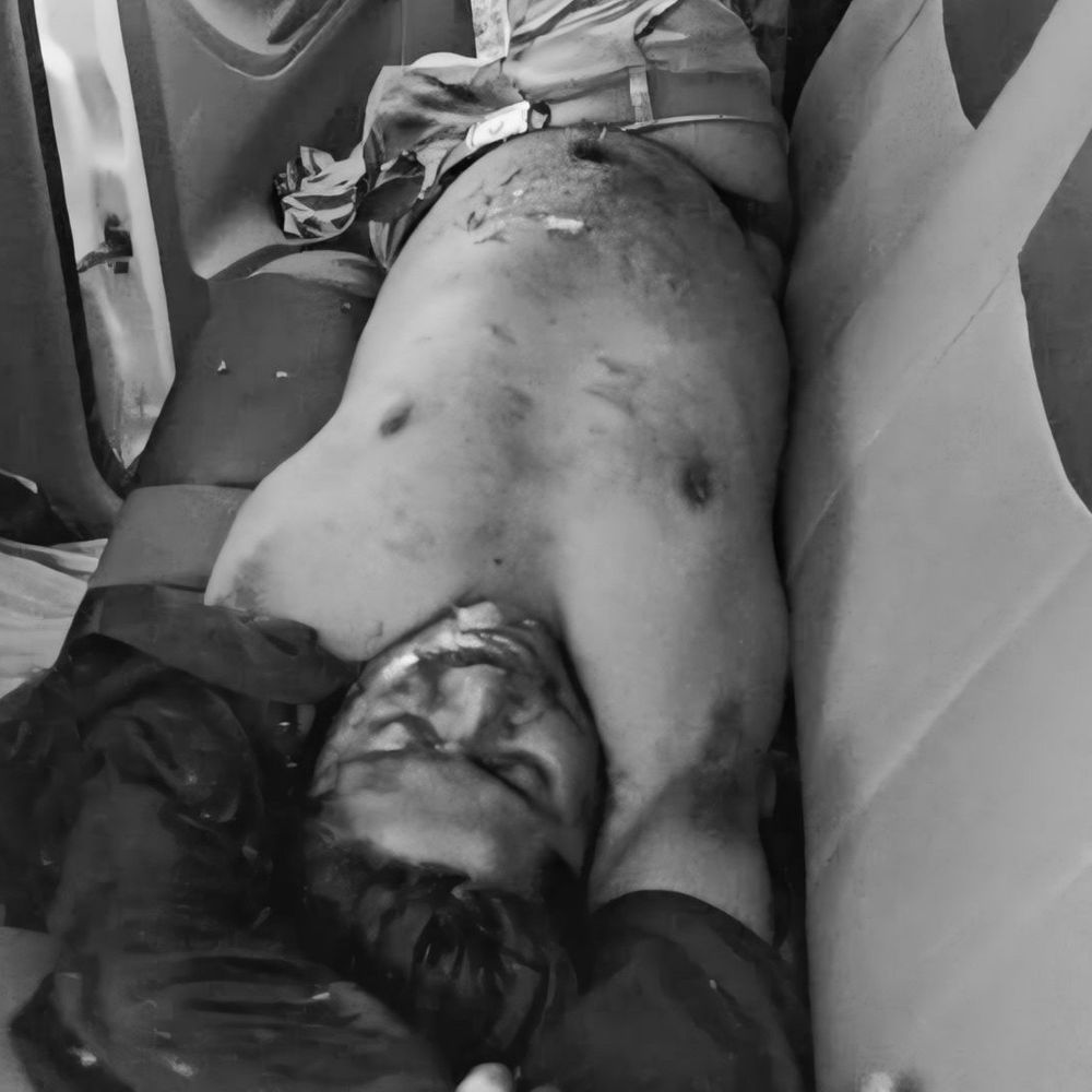 बुरहानपुर में सड़क हादसे में बाइक सवार की मौत:इंदौर-इच्छापुर हाईवे पर हादसा, पुलिस ने पहुंचाया अस्पताल