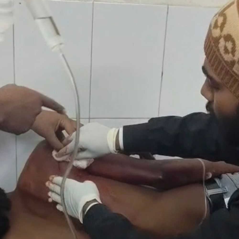 बलिया में पैसे के विवाद में युवक को चाकू मारा:गंभीर हालत में भर्ती, पुलिस ने दो संदिग्धों को हिरासत में लिया