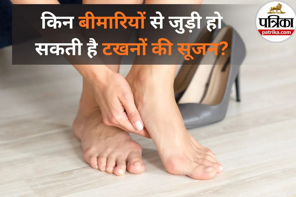 Ankle Swelling Causes: पैर दे रहे हैं इन खतरनाक बीमारी का साइलेंट अलर्ट! इस सूजन को बिल्कुल न करें नजरअंदाज
