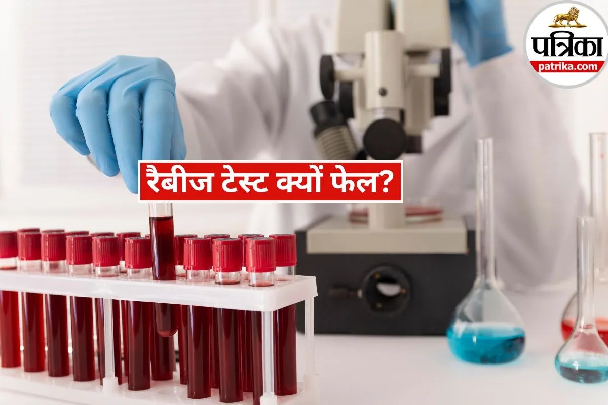 Human Rabies Test: रेबीज पकड़ में क्यों नहीं आता? ये 1 बड़ी गलती कर देते हैं ज्यादातर लोग और डॉक्टर!