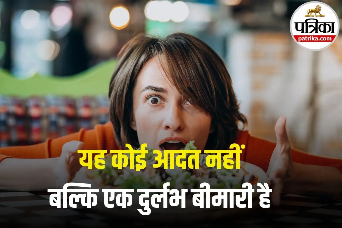 Marcus Gunn Syndrome: क्या खाते समय आपकी भी आंखें झपकती है? हो सकती है ये दुर्लभ बीमारी, जानिए लक्षण और बचाव