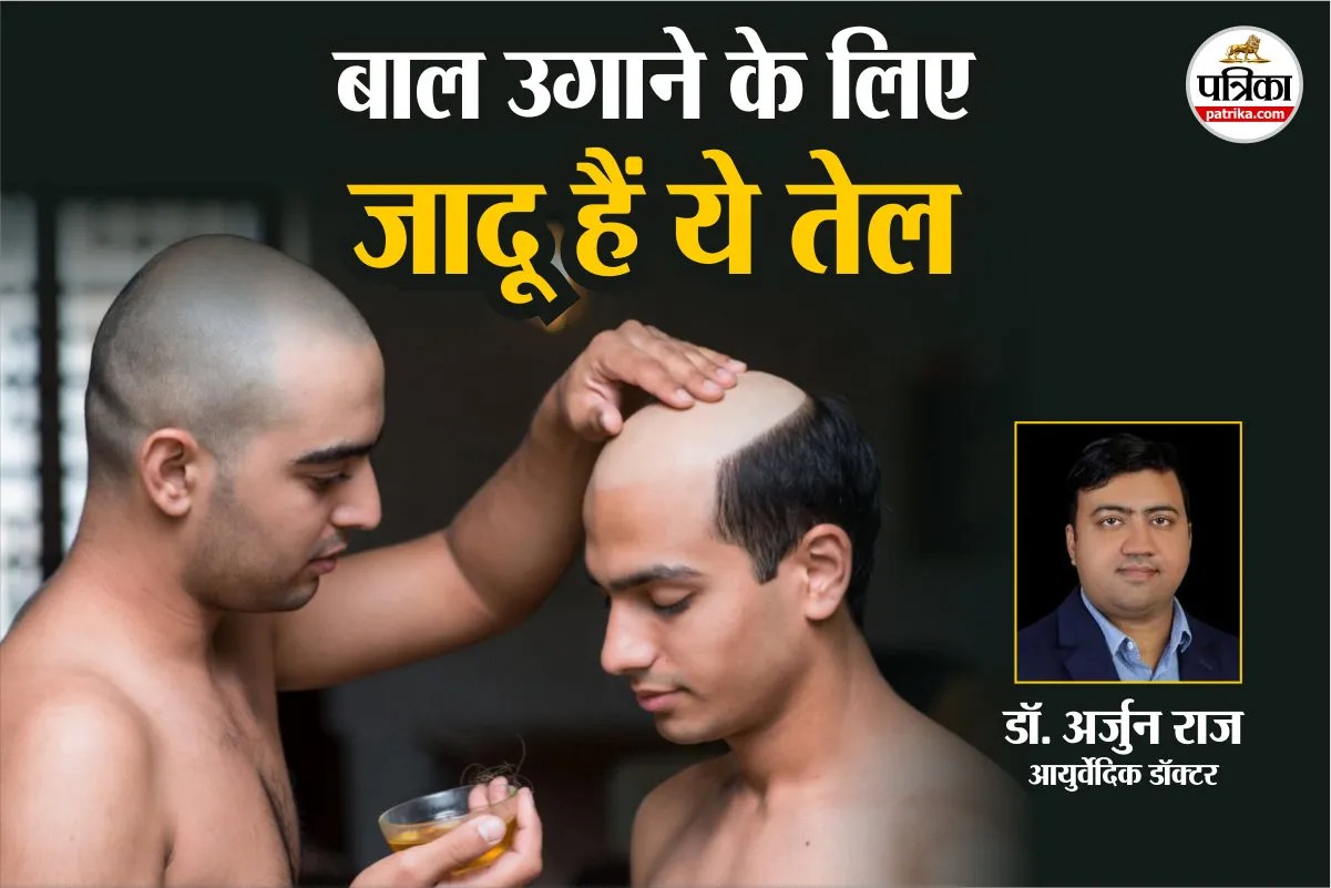 गंजापन दूर! ये 4 तेल नए बाल उगाने में कारगर, आयुर्वेदिक डॉक्टर ने बताया