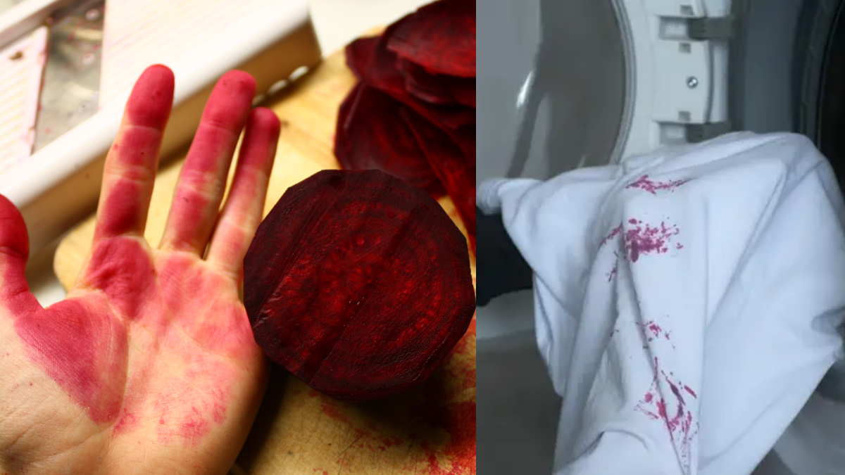 कपड़े पर लगे चुकंदर के निशान कैसे छुड़ाएं, इन तरीकों से लाल हो चुके हाथ भी हो जाएंगे साफ, बस कर लें ये उपाय