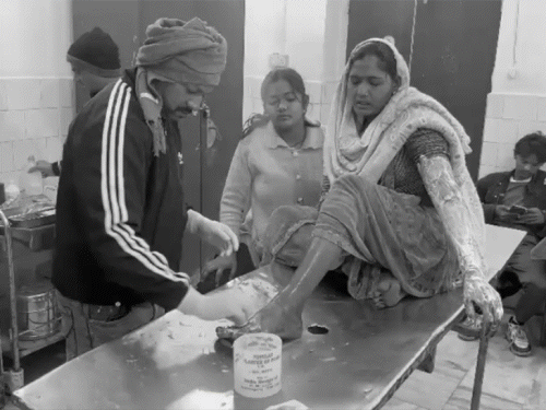 गिरिडीह में समोसा दुकान चलाने वाली महिला को छेड़ा:विरोध करने पर फेंका गर्म तेल, परिजन लेकर पहुंचे अस्पताल, एक धराया