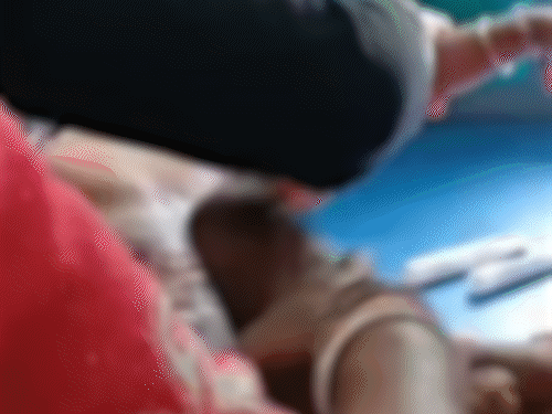 नहाते समय टब पलटा, पेट-पैर झुलसे; अस्पताल रेफर:जमुई में ढाई साल का बच्चा गर्म पानी से झुलसा, असंतुलित होकर गिरा