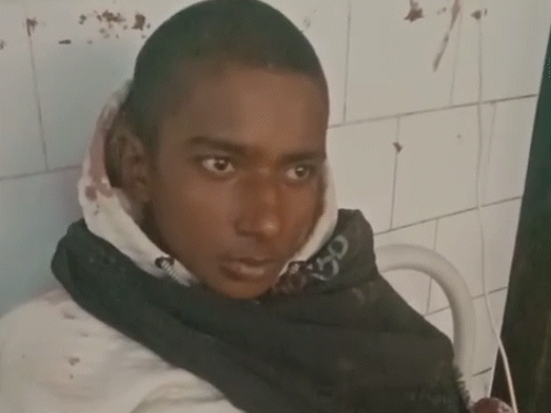 भागलपुर में नाबालिग की बेरहमी से पिटाई, अस्पताल में भर्ती:इंस्टाग्राम पर स्टेटस लगाने को लेकर हुआ था विवाद, गांव के लड़कों ने घेरकर मारा