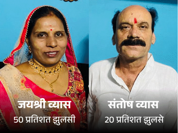 सतवास की जयश्री 50 प्रतिशत, संतोष व्यास 20 फीसदी जले:घाव भरने में काफी समय लगेगा; बर्न एक्सपर्ट से समझिए कितने जलने पर क्या होती है कंडीशन