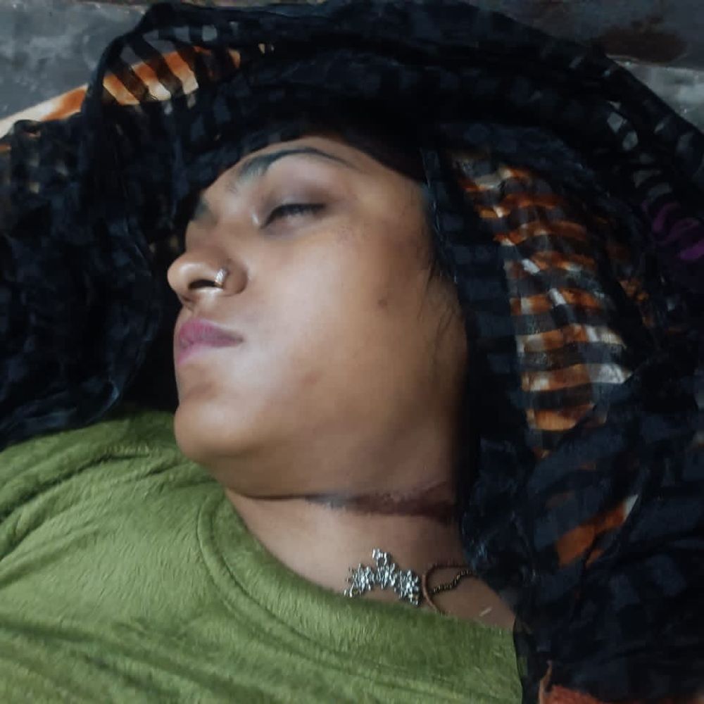 विवाहिता की संदिग्ध मौत, हाथ पर चाकू के घाव:मायके वालों ने पति और ससुराल पर हत्या का आरोप लगाया