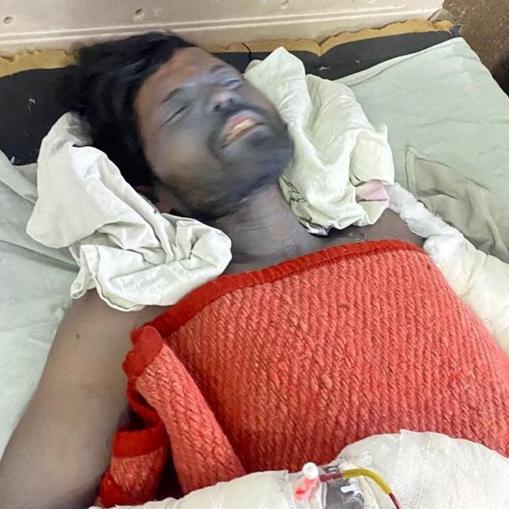 रीवा के गुढ़ में पटाखा व्यापारी के घर विस्फोट:आग में 4 लोग झुलसे, दो की हालत गंभीर; फायरमैन भी घायल