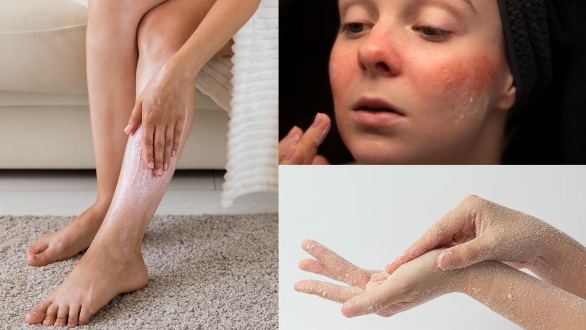 बार बार हाथ-पैर पर आ रहे हैं ड्राई रैशेज तो सोने से पहले कर लें ये काम, पूरी सर्दियां स्किन रहेगी सॉफ्ट