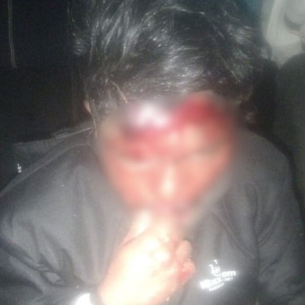 सड़क हादसे में दो युवक गंभीर घायल:फतेहपुर-वजीरगंज मार्ग पर बाइक नहर में गिरी, एक रेफर