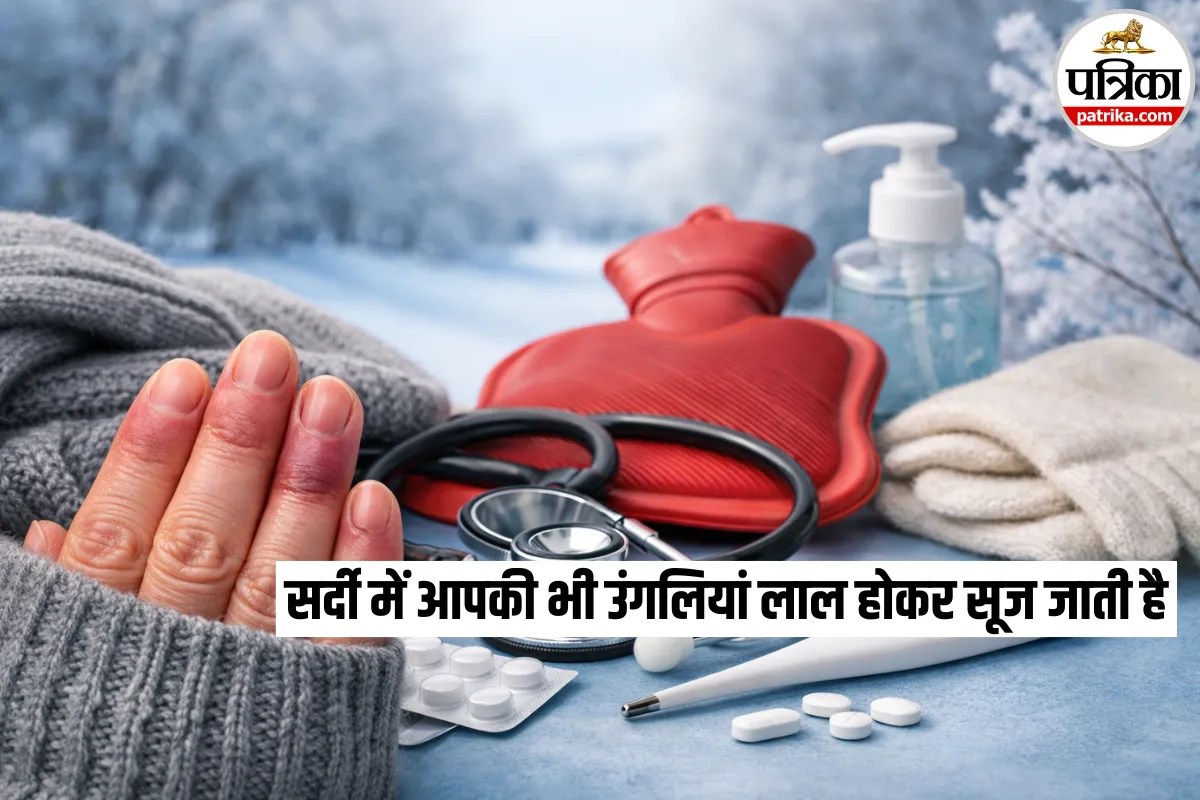 Winter Skin Disease: उंगलियों में दिखते है ये संकेत तो हो सकती है ये गंभीर बीमारी! डॉक्टर से जानें इसका कारण और बचाव का उपाय