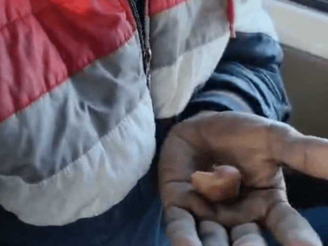 जोधपुर में जीजा ने साले की काटी नाक, VIDEO:पत्नी के दूसरे युवक के साथ शादी करने से था नाराज, आरोपी की तलाश जारी