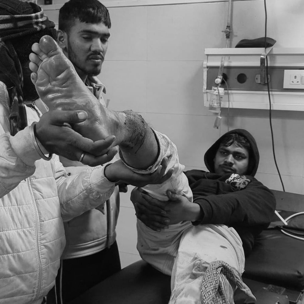 पुलिस को देखकर भाग रहे तस्कर का पैर टूटा:भोजपुर में 40 लीटर देसी शराब बरामद; साथी मौके से फरार, तलाश में जुटी पुलिस