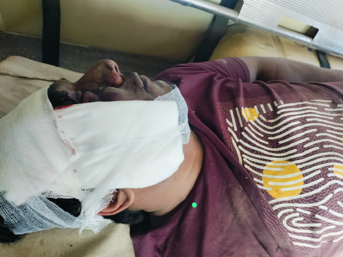 उत्तरायण पर इमरजेंसी: सिविल अस्पताल में 116 मरीज पहुंचे, कुछ गंभीर