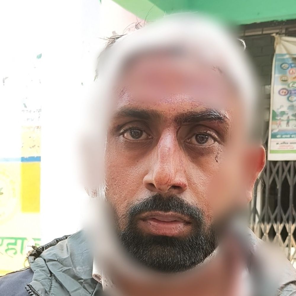 पुरानी रंजिश में दो पक्षों में खूनी संघर्ष:रास्ता घेर कर की मारपीट, 4 घायल, पुलिस जांच में जुटी