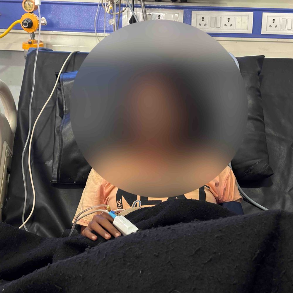 मोतिहारी में ग्रेजुएशन की छात्रा पर एसिड अटैक:डॉक्टर ने कहा- चेहरे और आंख पर ज्यादा असर; मां बोली- मामा के बेटे ने किया हमला