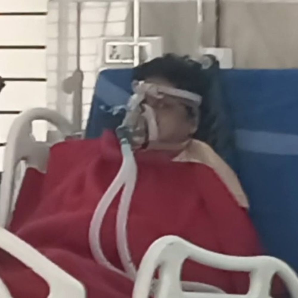 मरीज के गले में अटका बाल और लकड़ी का तिनका:पत्नी ने तुरंत बाहर निकाला, कोरबा मेडिकल कॉलेज अस्पताल में खाने के दौरान हुई घटना