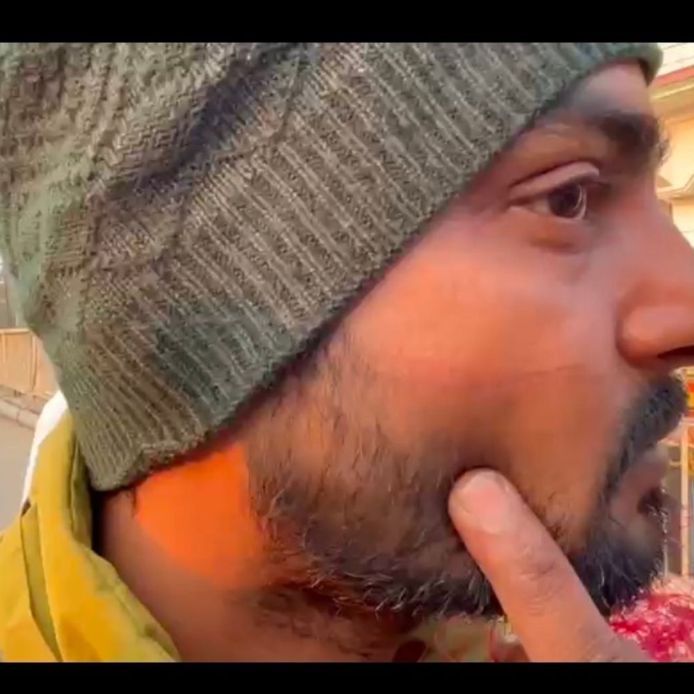 मऊ में चाइनीज मांझे से तीन लोग घायल:प्रतिबंध के बावजूद बिक रहे, बाइक सवारों को चेहरे और नाक पर गंभीर चोट