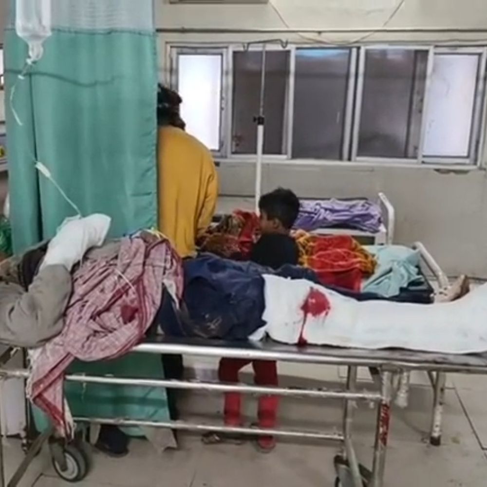 फरीदाबाद में रेलवे कर्मचारी गंभीर रूप से घायल:चलती ट्रेन से उतरते समय हादसा, पैर और हाथ में फ्रैक्चर; दिल्ली रेफर