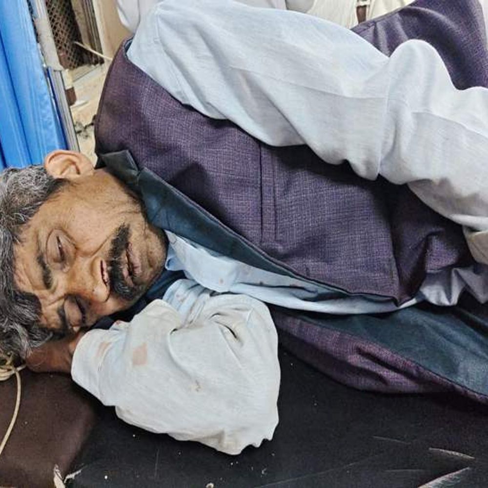 इंदौर के तेजाजी नगर में कार डिवाइडर से टकराई:राजस्थान के 11 लोग घायल, 2 की हालत गंभीर; एमवाय हॉस्पिटल में चल रहा इलाज