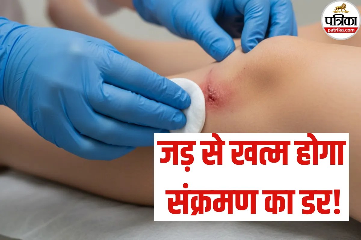 Bacteria Treatment: महंगी एंटीबायोटिक दवाओं से मिलेगा छुटकारा! पुराने घाव होंगे EET Neutralization से ठीक