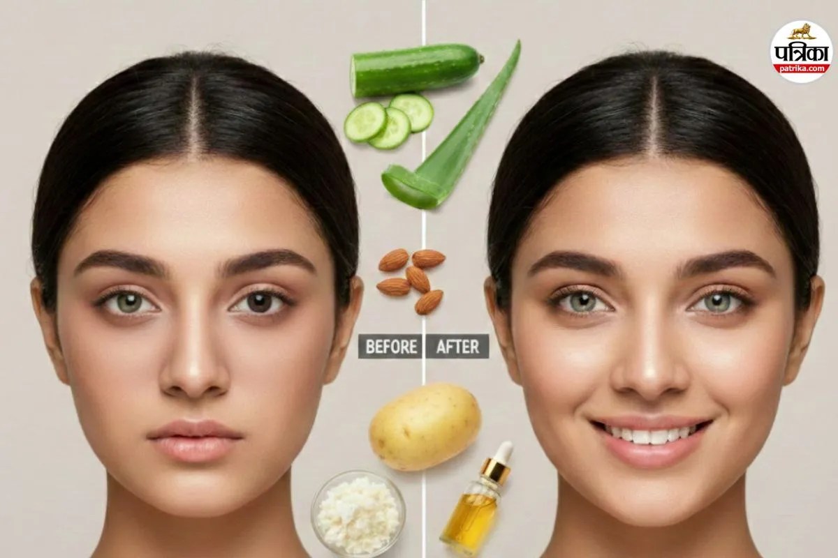 Dark Circles Remedies: कहीं आपकी खूबसूरती न छीन लें ये डार्क सर्कल्स, इन 5 असरदार नुस्खों से दोबारा लौटाएं अपनी चमक