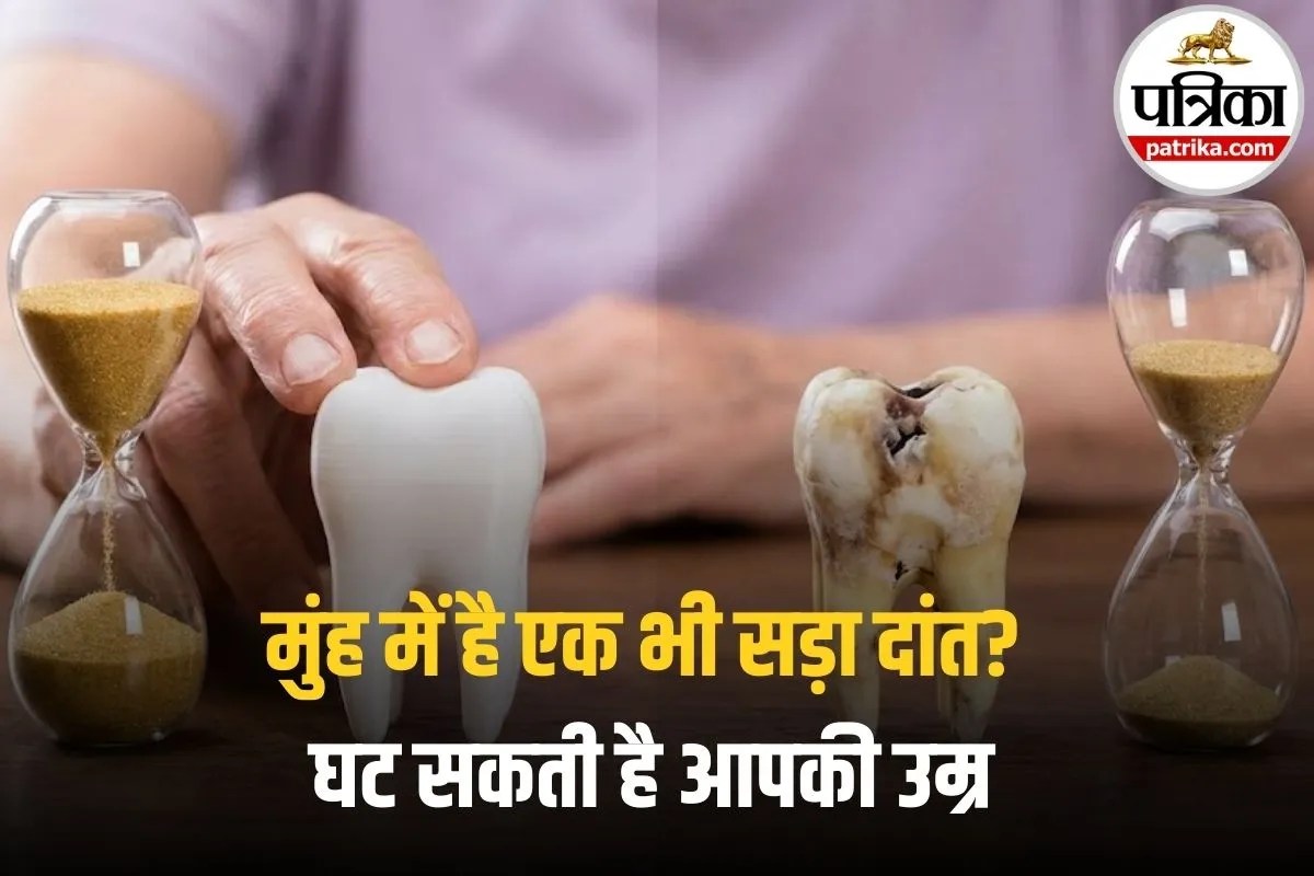 Healthy Teeth Benefits: सावधान! मुंह में है एक भी सड़ा दांत? तो घट सकती है आपकी उम्र, रिसर्च में हुआ चौंकाने वाला खुलासा