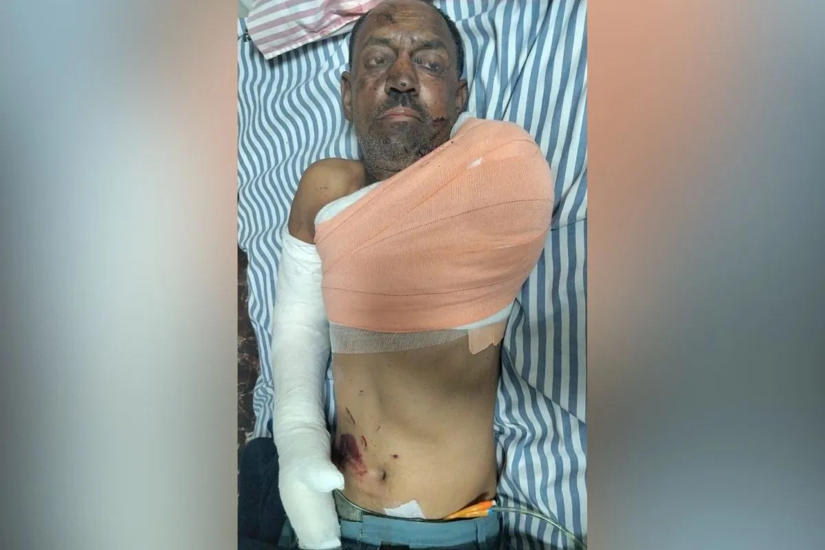 डूंगरपुर में ट्रैक्टर की वेल्डिंग के दौरान अचानक हुआ विस्फोट, युवक का हाथ कटा