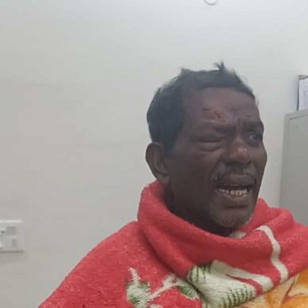 छत्तर गांव में दो भाइयों पर हमला, गंभीर घायल:गांव के लोगों पर मारपीट का आरोप, सीएचसी में हुआ इलाज