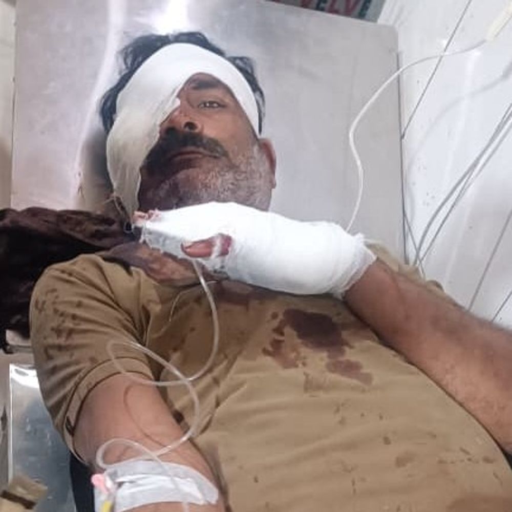 पिता के अपमान का विरोध करने पर काटीं तीन उंगलियां:सीतापुर में शराबी युवक ने पड़ोसी पर किया हमला, आरोपी फरार