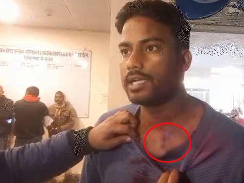 दरभंगा में मूर्ति विसर्जन के दौरान फायरिंग:एक युवक को गर्दन के नीचे लगी बुलेट, गंभीर हालत में DMCH में चल रहा है इलाज