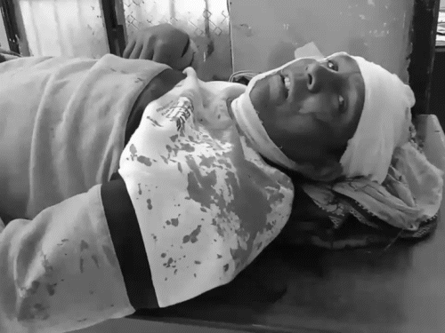 दरभंगा में पैसे के विवाद में घर में घुसकर हमला:महिला-बच्चे समेत 10 लोग जख्मी; पुलिस पर आवेदन लेने से इनकार करने का आरोप