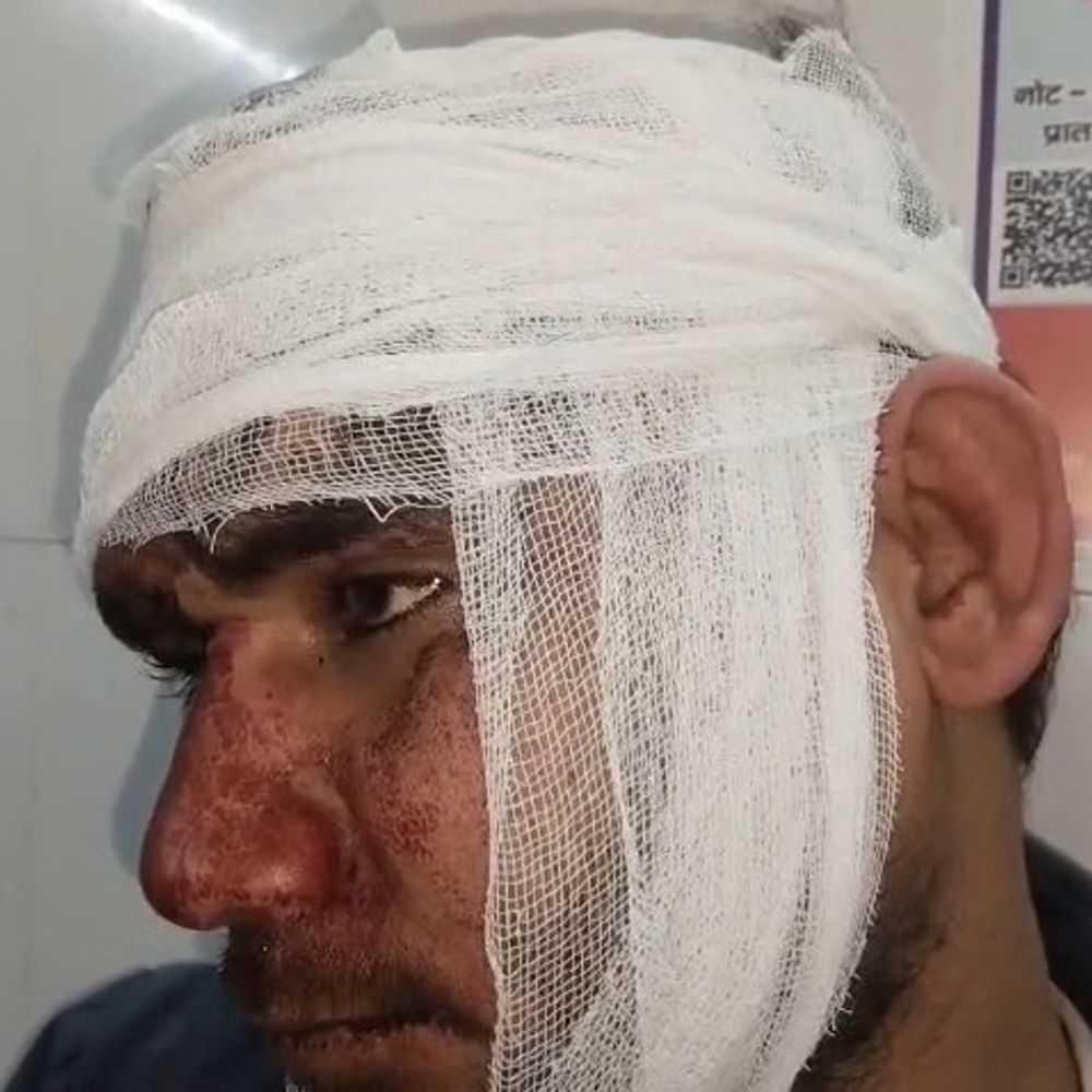 मुर्गा खरीदने के विवाद में युवक की पिटाई:महोबा में दबंगों ने पीटा, गंभीर हालत में अस्पताल में भर्ती