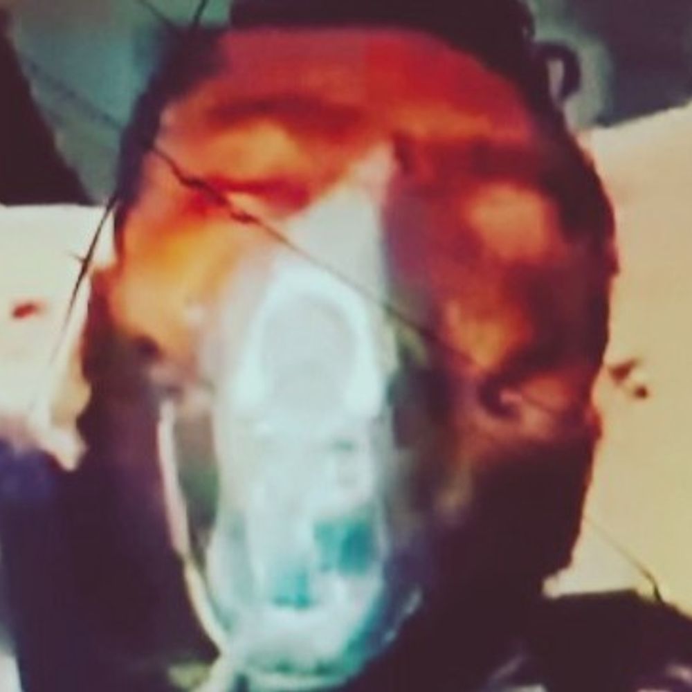 गभाना में युवक ने ममेरे भाई को मारी गोली:आपसी विवाद पर सिर में दागा निशाना, डॉग स्क्वॉड मौके पर पहुंची; जांच जारी