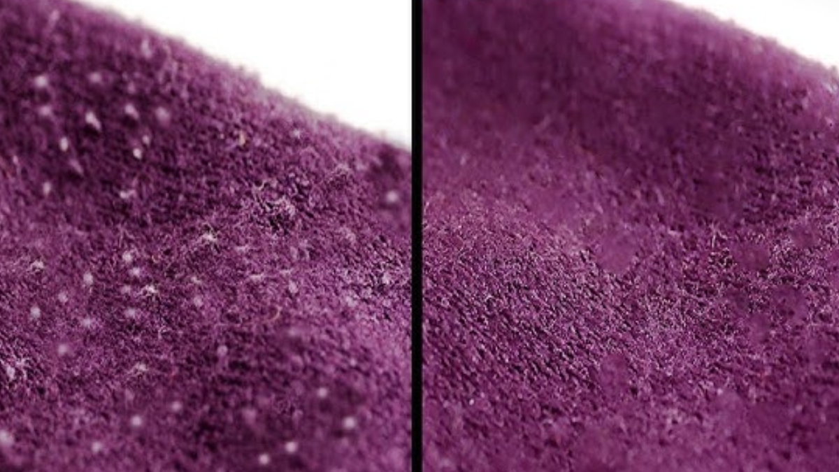 ऊनी कपड़ों पर दिख रहे हैं रोएं, तो ऐसे मिटाएं इनका नामोनिशान, एकदम नए जैसे लगने लगेंगे स्वेटर