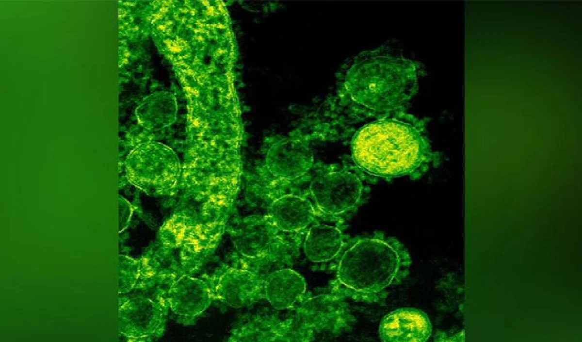 West Bengal में 19 साल बाद निपाह वायरस की दस्तक, कितना खतरनाक, क्या है इससे बचने का तरीका?