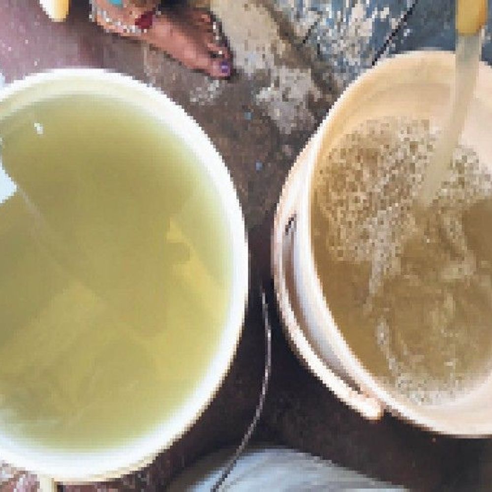 अब तक 21 मौतें:दूषित पानी से एक और जान गई