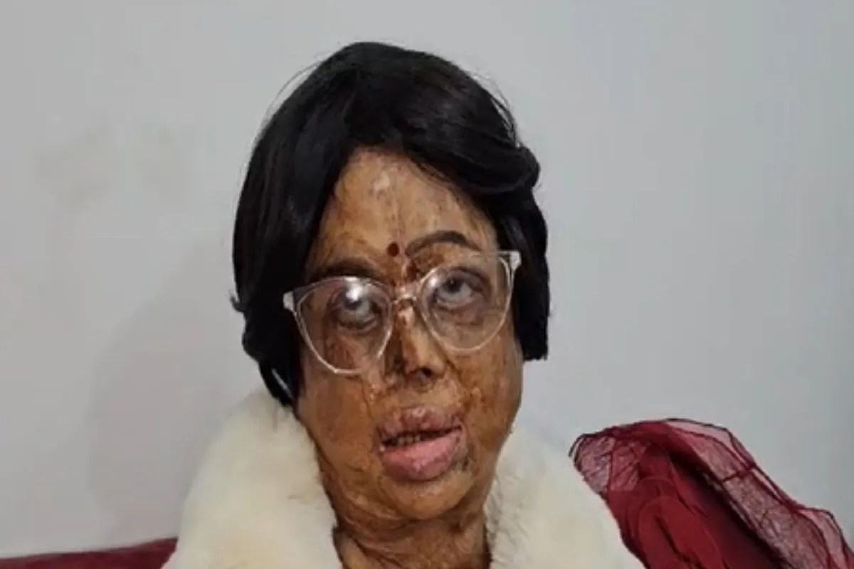 पद्मश्री सम्मान से गदगद एसिड अटैक सर्वाइवर मंगला कपूर, बोलीं-पीएम के शब्दों ने हौसला दिया