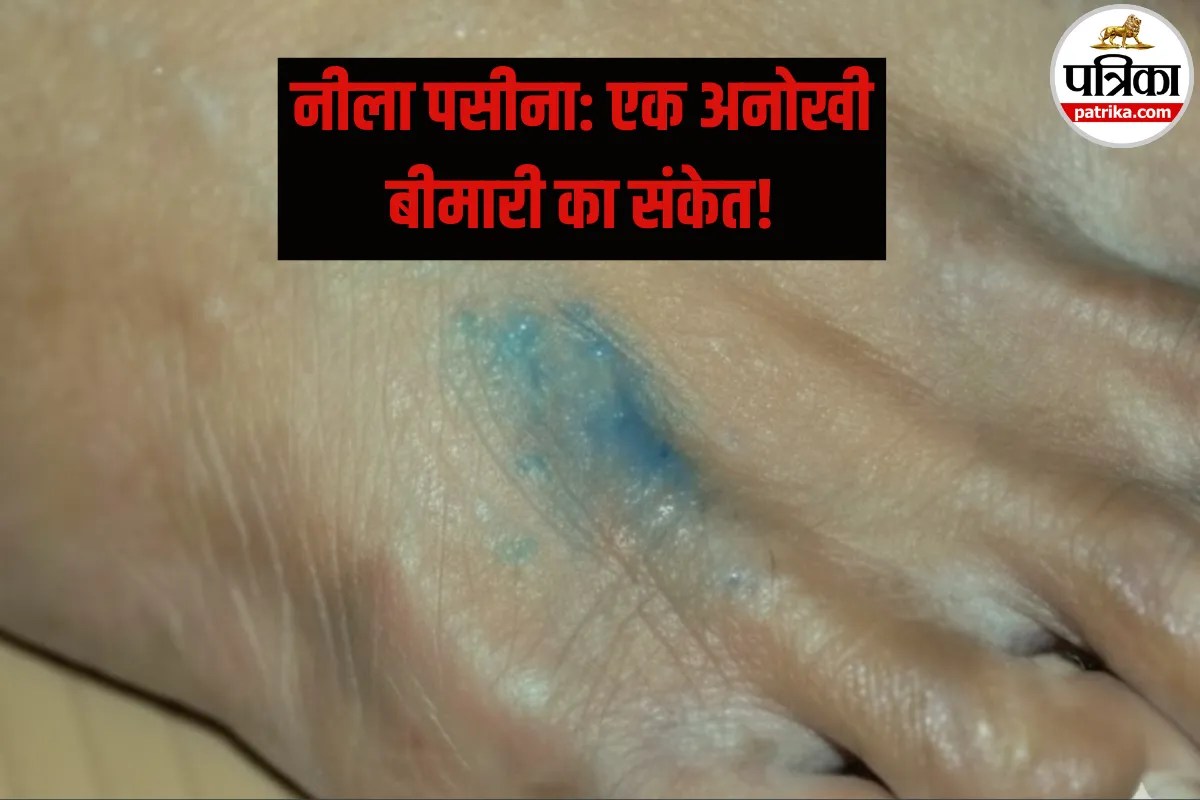 Skin Disease: इस खतरनाक बीमारी में आता है रंगीन पसीना! अभी जानें क्या होती है Chromhidrosis