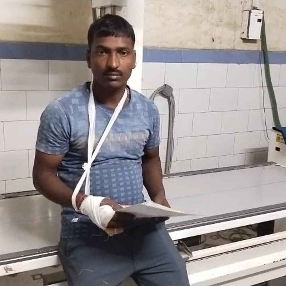 तेज रफ्तार बाइक बेकाबू होकर पलटी:औरंगाबाद में 3 लोग जख्मी, सभी एक ही बाइक पर थे सवार